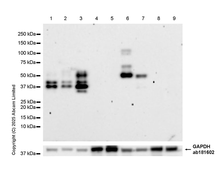 Western blot - Anti-Tau (N-terminal) antibody [EPR29521-8] (AB324236), expandable thumbnail