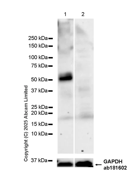Western blot - Anti-Tau (N-terminal) antibody [EPR29521-8] (AB324236)