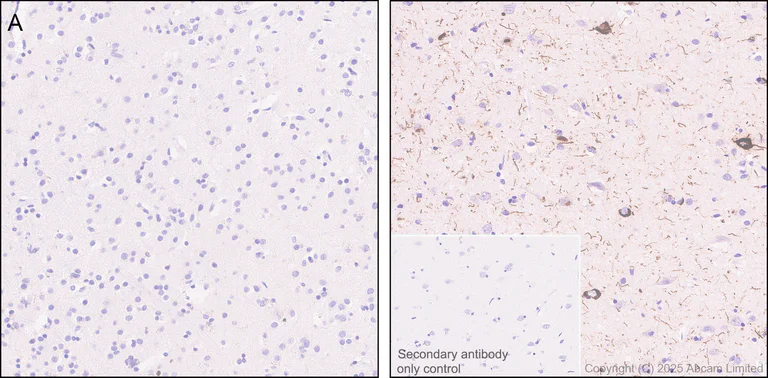 Immunohistochemistry (Formalin/PFA-fixed paraffin-embedded sections) - Anti-Tau (PDR P2 region) antibody [EPR30099-573] (AB324252)