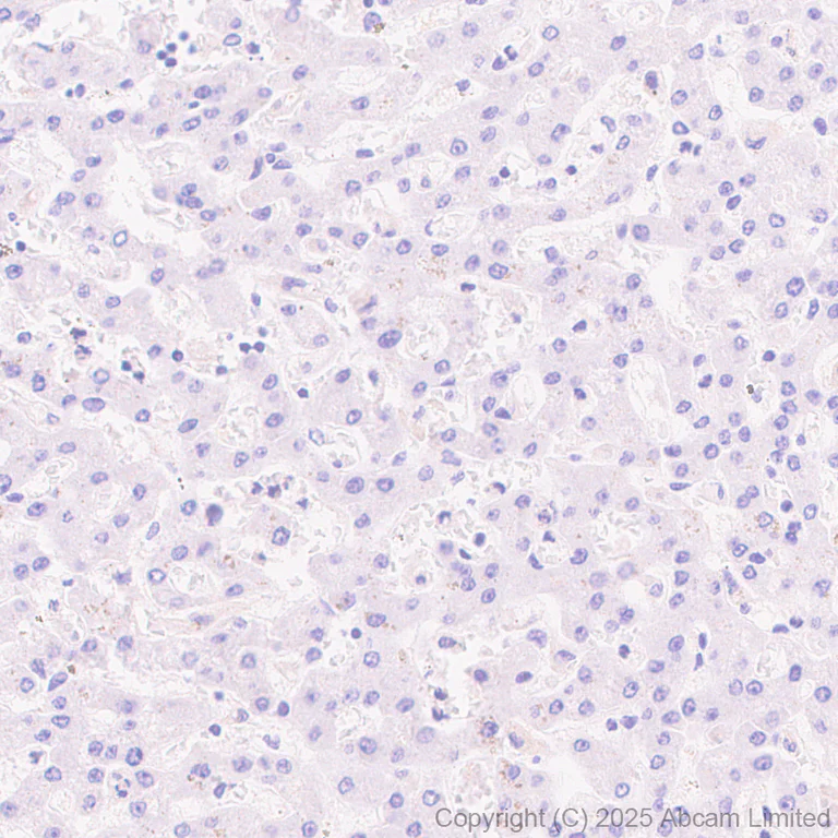 Immunohistochemistry (Formalin/PFA-fixed paraffin-embedded sections) - Anti-Tau (PDR P2 region) antibody [EPR30099-573] (AB324252)