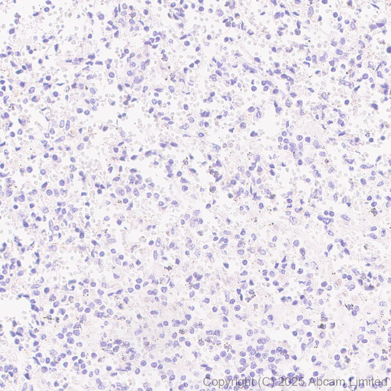 Immunohistochemistry (Formalin/PFA-fixed paraffin-embedded sections) - Anti-Tau (PDR P2 region) antibody [EPR30099-573] (AB324252)
