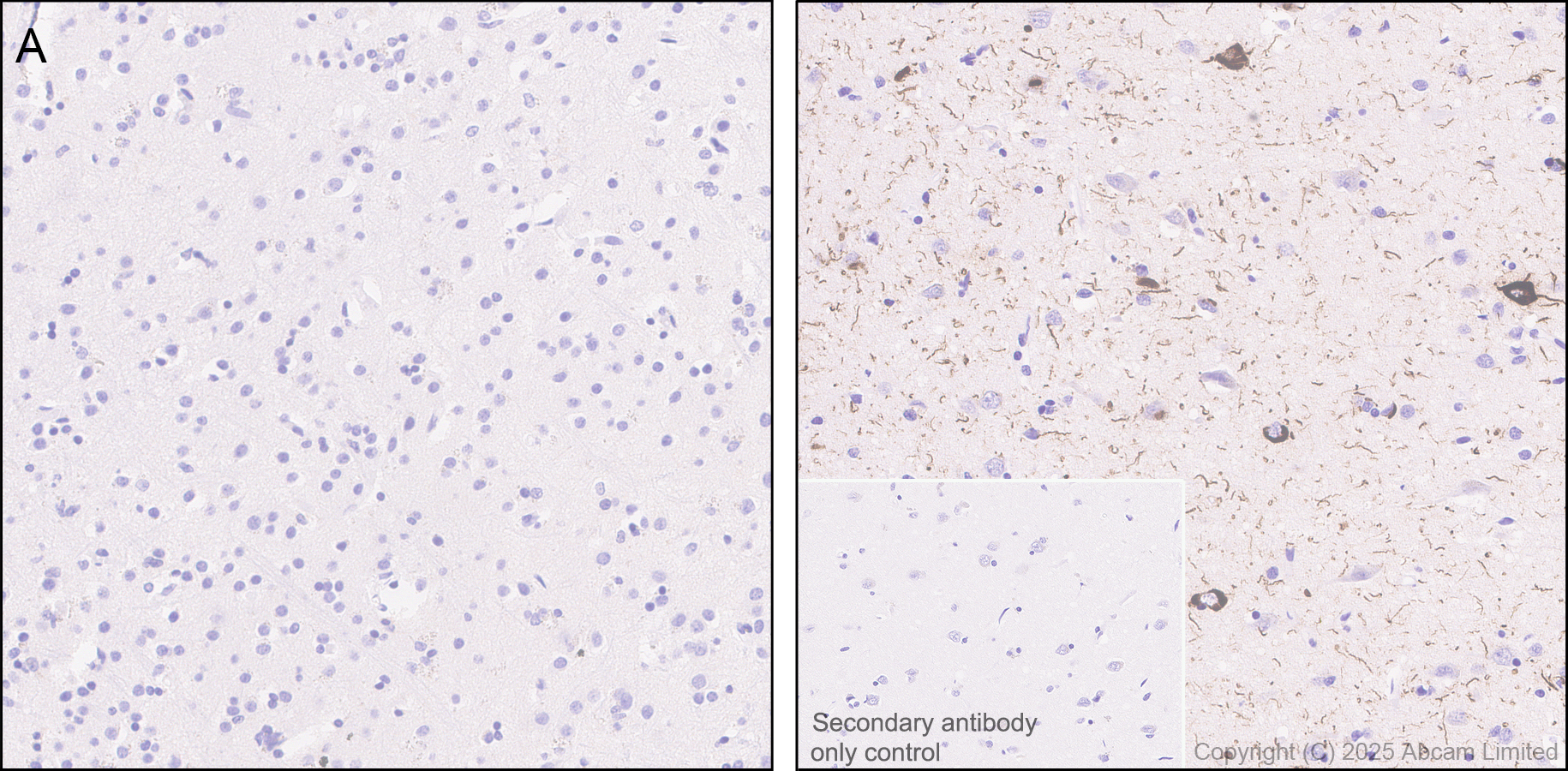 Immunohistochemistry (Formalin/PFA-fixed paraffin-embedded sections) - Anti-Tau (PDR P2 region) antibody [EPR30099-573]  - BSA and Azide free (AB324253), expandable thumbnail