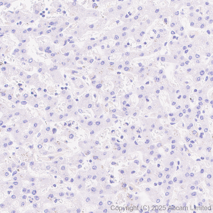 Immunohistochemistry (Formalin/PFA-fixed paraffin-embedded sections) - Anti-Tau (PDR P2 region) antibody [EPR30099-573]  - BSA and Azide free (AB324253), expandable thumbnail