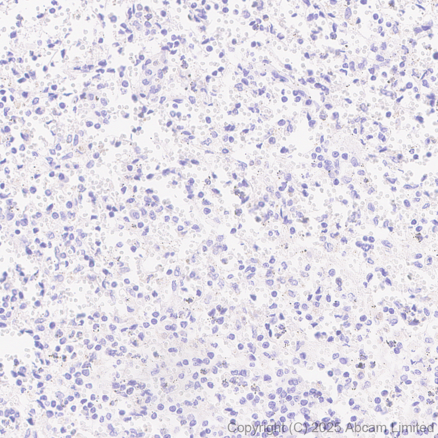 Immunohistochemistry (Formalin/PFA-fixed paraffin-embedded sections) - Anti-Tau (PDR P2 region) antibody [EPR30099-573]  - BSA and Azide free (AB324253), expandable thumbnail