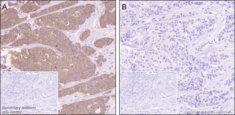 Immunohistochemistry (Formalin/PFA-fixed paraffin-embedded sections) - Anti-Tau (phospho S198) antibody [EPR2400] (AB79540)