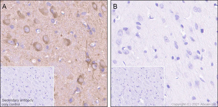 Immunohistochemistry (Formalin/PFA-fixed paraffin-embedded sections) - Anti-Tau (phospho S198) antibody [EPR2400] (AB79540)