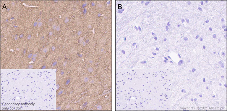 Immunohistochemistry (Formalin/PFA-fixed paraffin-embedded sections) - Anti-Tau (phospho S198) antibody [EPR2400] (AB79540)