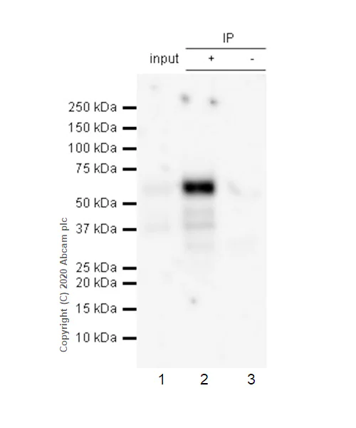 Immunoprecipitation - Anti-Tau (phospho S198) antibody [EPR2400] (AB79540)