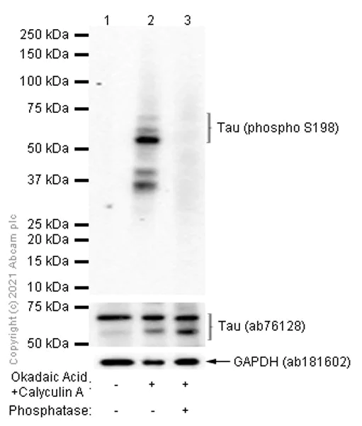 Western blot - Anti-Tau (phospho S198) antibody [EPR2400] (AB79540)