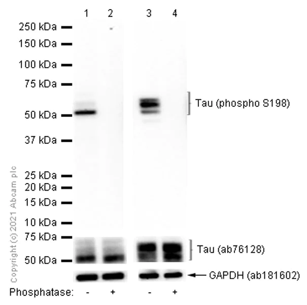 Western blot - Anti-Tau (phospho S198) antibody [EPR2400] (AB79540)