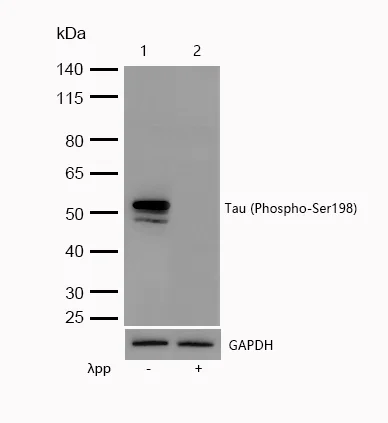 Western blot - Anti-Tau (phospho S198) antibody [SR1857] (AB326670)