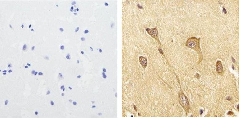 Immunohistochemistry (Formalin/PFA-fixed paraffin-embedded sections) - Anti-Tau (phospho S199) antibody (AB4749), expandable thumbnail