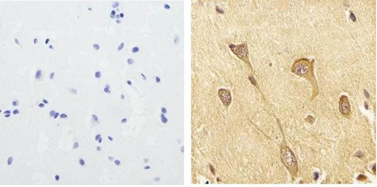 Immunohistochemistry (Formalin/PFA-fixed paraffin-embedded sections) - Anti-Tau (phospho S199) antibody (AB4749)