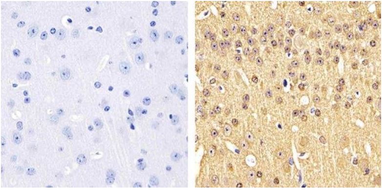 Immunohistochemistry (Formalin/PFA-fixed paraffin-embedded sections) - Anti-Tau (phospho S199) antibody (AB4749), expandable thumbnail