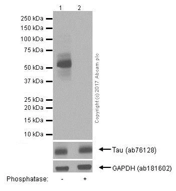 Western blot - Anti-Tau (phospho S199) antibody [EPR2401Y] (AB81268)