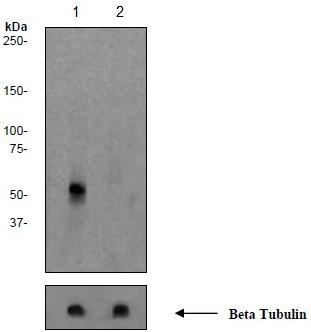 Western blot - Anti-Tau (phospho S199) antibody [EPR2401Y] (AB81268), expandable thumbnail