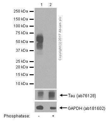 Western blot - Anti-Tau (phospho S199) antibody [EPR2401Y] (AB81268)