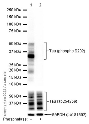 Western blot - Anti-Tau (phospho S202) antibody [EPR2402] (AB108387), expandable thumbnail
