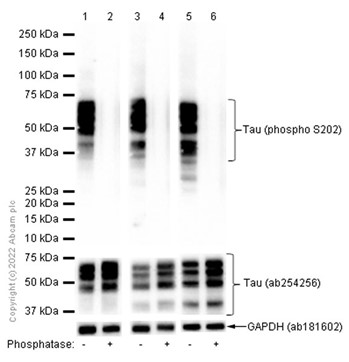 Western blot - Anti-Tau (phospho S202) antibody [EPR2402] (AB108387), expandable thumbnail