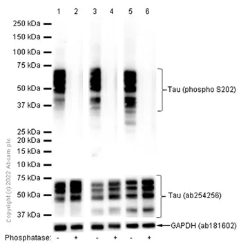 Western blot - Anti-Tau (phospho S202) antibody [EPR2402] - BSA and Azide free (AB196359)