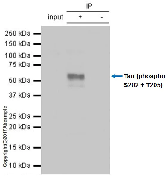 Immunoprecipitation - Anti-Tau (phospho S202 + T205) antibody [EPR20390] - BSA and Azide free (AB237594)