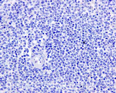 Immunohistochemistry (Formalin/PFA-fixed paraffin-embedded sections) - Anti-Tau (phospho S214) antibody [EPR1884(2)] (ab170892), expandable thumbnail