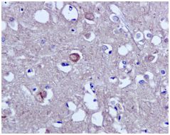 Immunohistochemistry (Formalin/PFA-fixed paraffin-embedded sections) - Anti-Tau (phospho S214) antibody [EPR1884(2)] (ab170892), expandable thumbnail