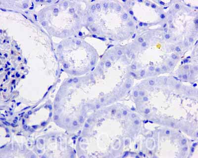 Immunohistochemistry (Formalin/PFA-fixed paraffin-embedded sections) - Anti-Tau (phospho S214) antibody [EPR1884(2)] (ab170892), expandable thumbnail