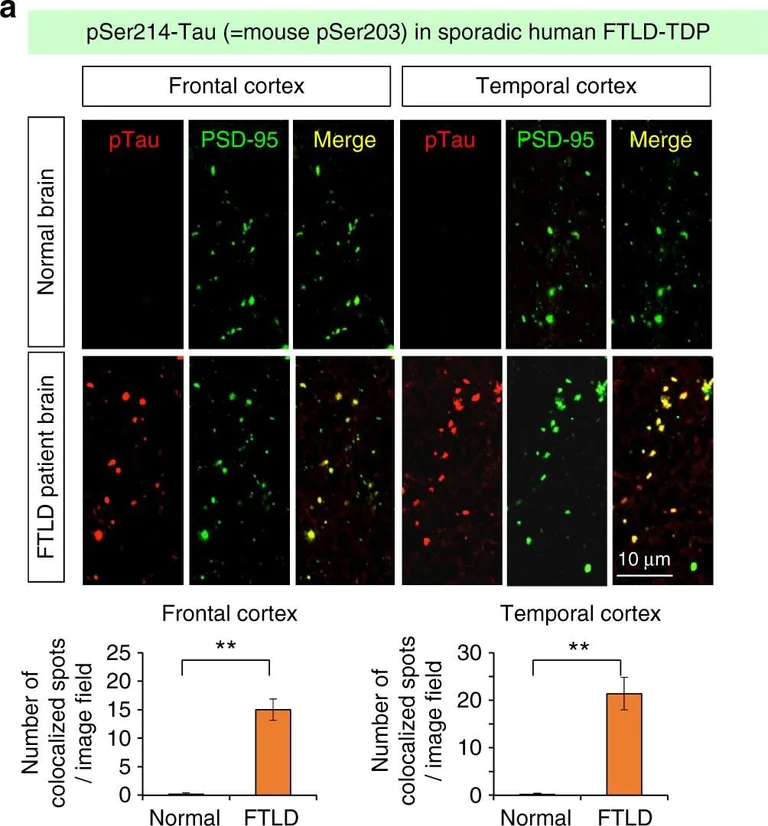 Immunohistochemistry - Anti-Tau (phospho S214) antibody [EPR1884(2)] (AB170892)