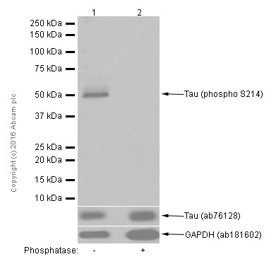 Western blot - Anti-Tau (phospho S214) antibody [EPR1884(2)] (AB170892), expandable thumbnail