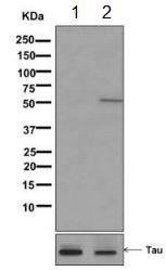 Western blot - Anti-Tau (phospho S214) antibody [EPR1884(2)] (AB170892), expandable thumbnail