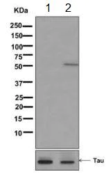 Western blot - Anti-Tau (phospho S214) antibody [EPR1884(2)] (AB170892)