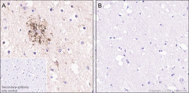 Immunohistochemistry (Formalin/PFA-fixed paraffin-embedded sections) - Anti-Tau (phospho S214) antibody [EPR1884(2)] - BSA and Azide free (AB196358)