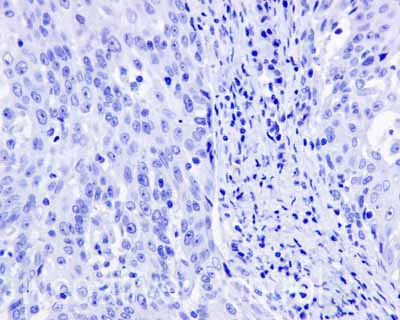 Immunohistochemistry (Formalin/PFA-fixed paraffin-embedded sections) - Anti-Tau (phospho S214) antibody [EPR1884(2)] - BSA and Azide free (AB196358)