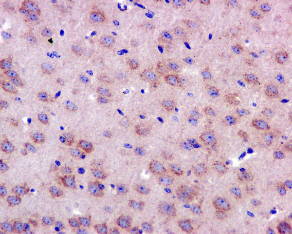 Immunohistochemistry (Formalin/PFA-fixed paraffin-embedded sections) - Anti-Tau (phospho S214) antibody [EPR1884(2)] - BSA and Azide free (AB196358)