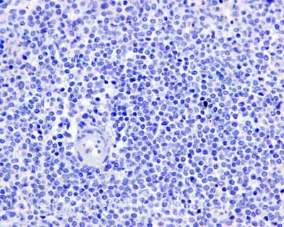Immunohistochemistry (Formalin/PFA-fixed paraffin-embedded sections) - Anti-Tau (phospho S214) antibody [EPR1884(2)] - BSA and Azide free (AB196358)