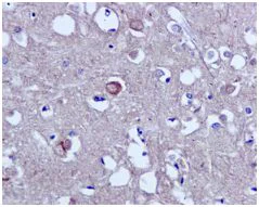 Immunohistochemistry (Formalin/PFA-fixed paraffin-embedded sections) - Anti-Tau (phospho S214) antibody [EPR1884(2)] - BSA and Azide free (AB196358)