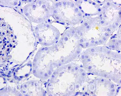 Immunohistochemistry (Formalin/PFA-fixed paraffin-embedded sections) - Anti-Tau (phospho S214) antibody [EPR1884(2)] - BSA and Azide free (AB196358)
