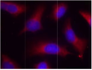 Immunocytochemistry/ Immunofluorescence - Anti-Tau (phospho S262) antibody (AB131354)