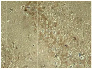 Immunohistochemistry (Formalin/PFA-fixed paraffin-embedded sections) - Anti-Tau (phospho S262) antibody (AB131354)