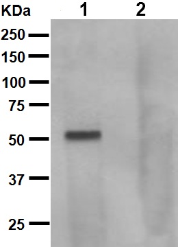 Western blot - Anti-Tau (phospho S262 + T263) antibody [EPR2454] (AB92627)