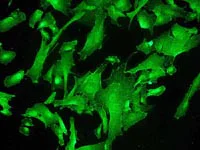 Immunocytochemistry/ Immunofluorescence - Anti-Tau (phospho S324) antibody [EPR2457(2)] (AB109401)