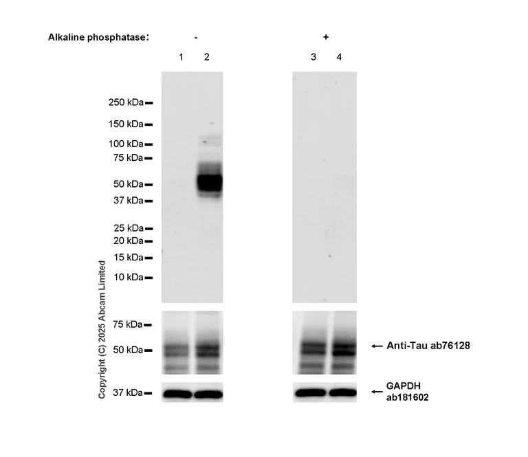 Western blot - Anti-Tau (phospho S324) antibody [EPR2457(2)] (AB109401)