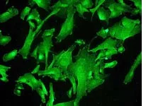 Immunocytochemistry/ Immunofluorescence - Anti-Tau (phospho S324) antibody [EPR2457(2)] - BSA and Azide free (AB196363)