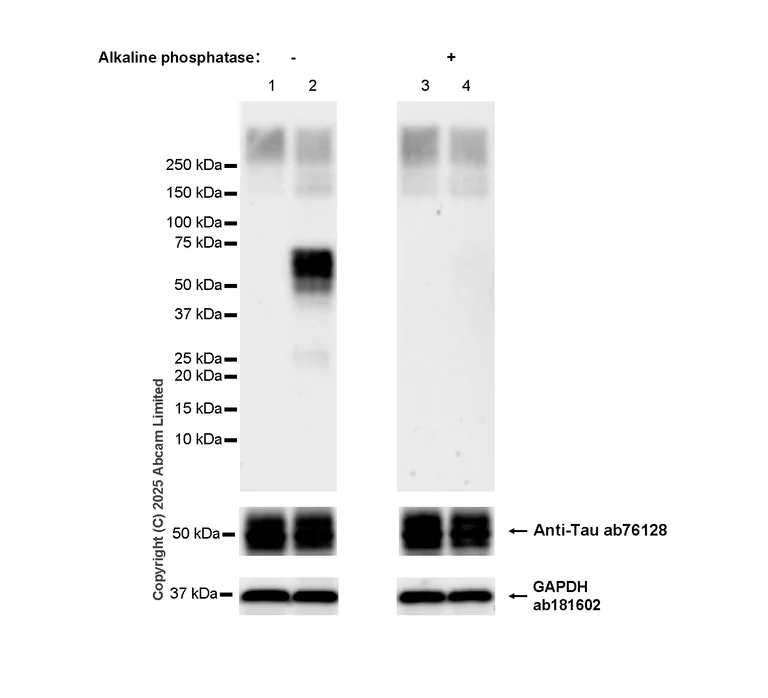 Western blot - Anti-Tau (phospho S324) antibody [EPR2457(2)] - BSA and Azide free (AB196363)
