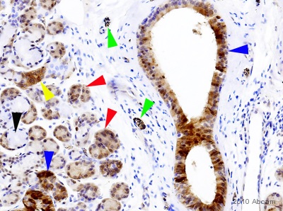 Immunohistochemistry (Formalin/PFA-fixed paraffin-embedded sections) - Anti-Tau (phospho S396) antibody [E178] (ab32057), expandable thumbnail
