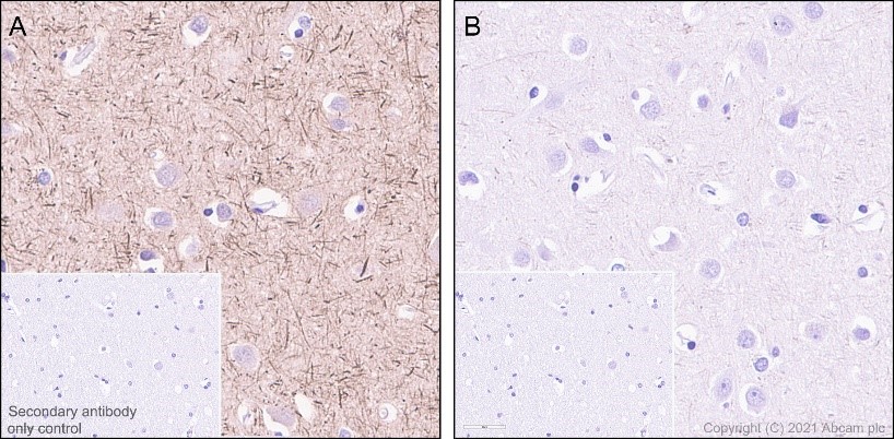 Immunohistochemistry (Formalin/PFA-fixed paraffin-embedded sections) - Anti-Tau (phospho S396) antibody [E178] (AB32057), expandable thumbnail