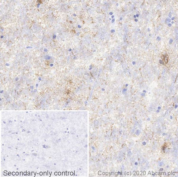 Immunohistochemistry (Frozen sections) - Anti-Tau (phospho S396) antibody [E178] (ab32057), expandable thumbnail