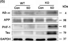 Western blot - Anti-Tau (phospho S396) antibody [E178] (ab32057), expandable thumbnail