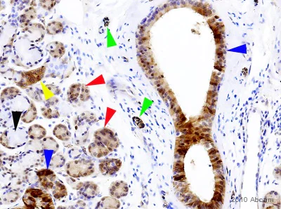 Immunohistochemistry (Formalin/PFA-fixed paraffin-embedded sections) - Anti-Tau (phospho S396) antibody [E178] - BSA and Azide free (AB218600)